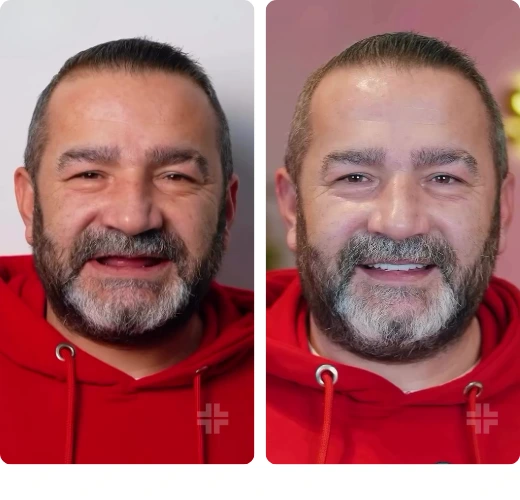 Treatment result 12