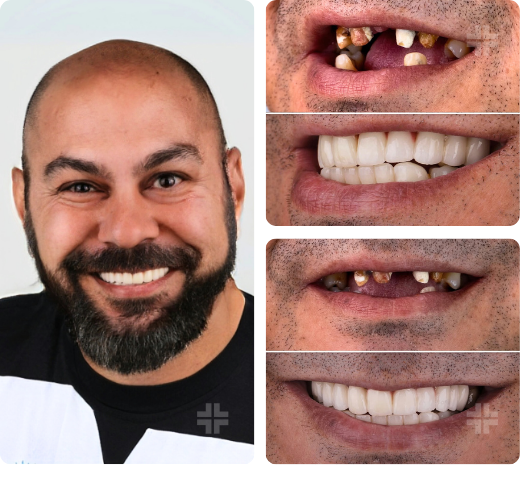 Treatment result 05
