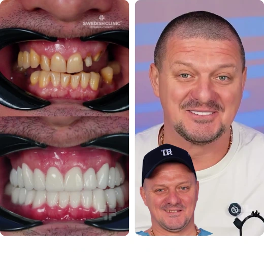 Treatment result 13