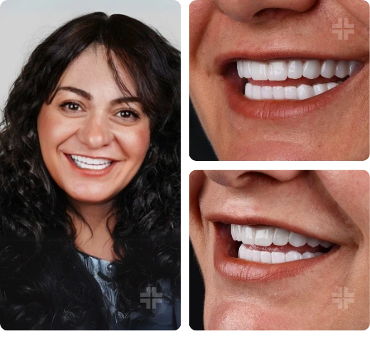 Treatment result 06